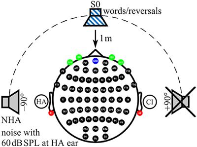 Changes in Speech-Related Brain Activity During Adaptation to Electro-Acoustic Hearing